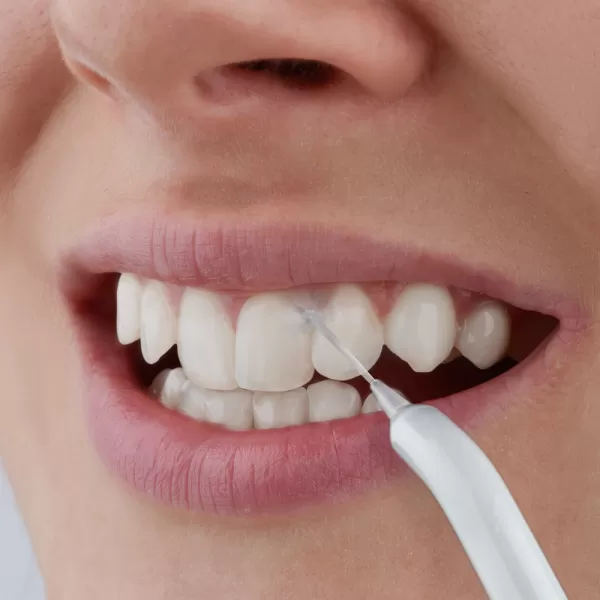 Ústní sprcha SENCOR SOI 2200SL