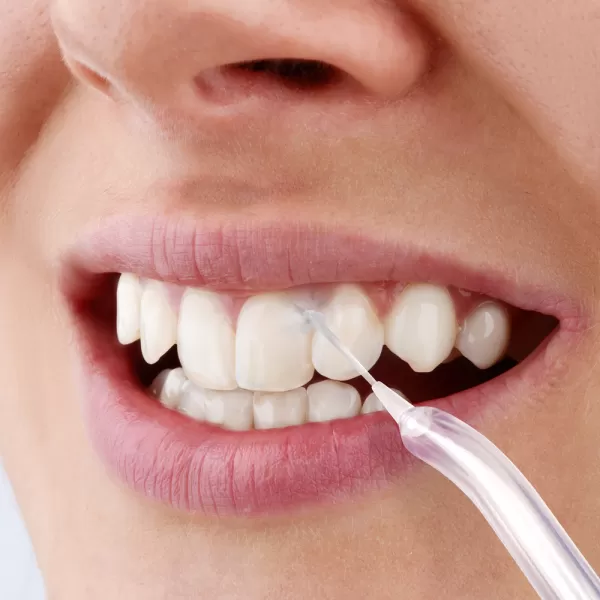 Ústní sprcha SENCOR SOI 3312WH